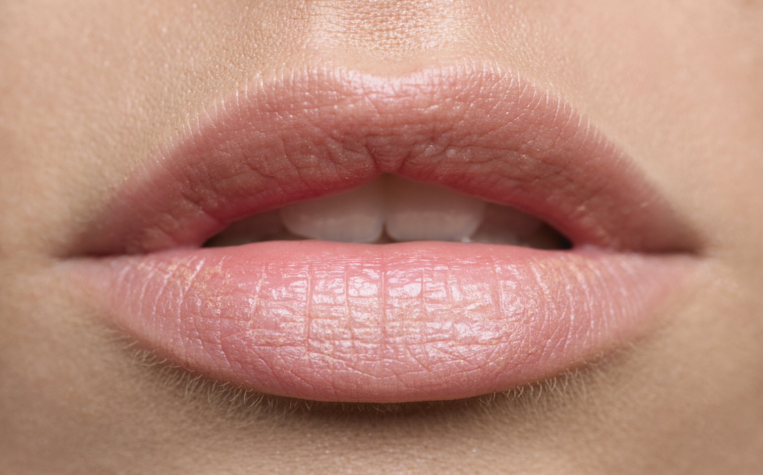 Lips: rub coconut oil or Vaseline on them. Exfoliate gently with a wet toothbrush. Once the dead skin is removed rub more coconut oil or Vaseline on them.
