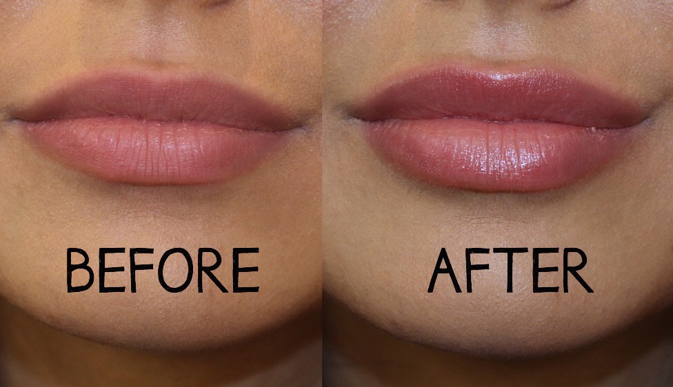 Get Plump Lips Fast