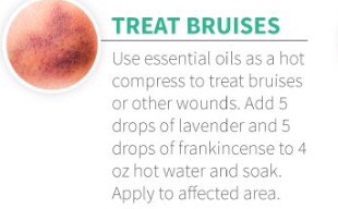 Natural Way To Treat Bruises!