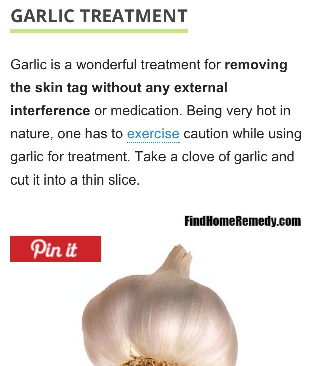 Home Remedies To Remove Skin  Tags 