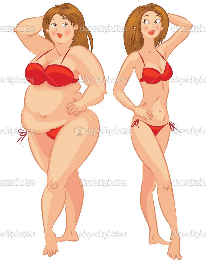 Treatment includes a combination of diet, exercise, behavior modification, and sometimes weightloss drugs. In some cases of severe obesity, gastrointestinal surgery may be recommended.