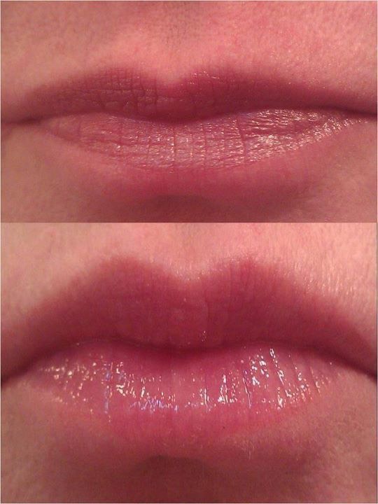 How To Get Fuller, Smoother And Shiner Lips In Days👄👀