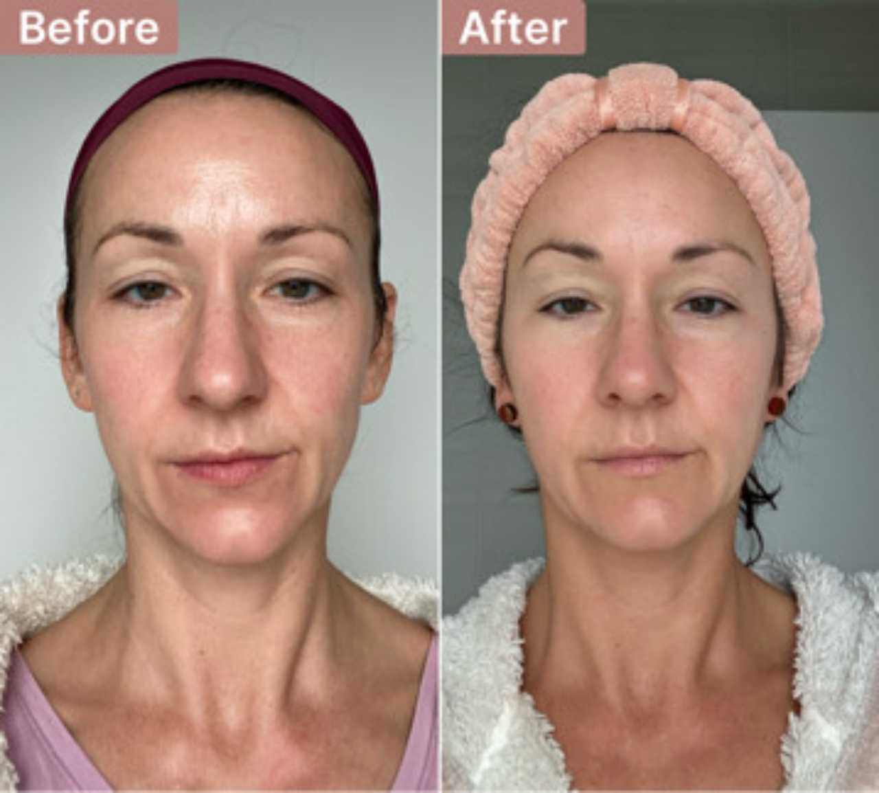 user-32-20636 -- before and after, 8 weeks