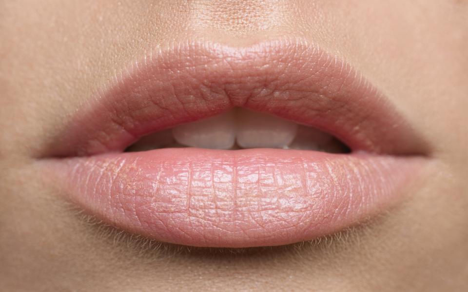 Chapped and cracked lips can be painful and uncomfortable. This simply, natural mixture will prevent your lips from peeling and drying up during the winter season. You will need: