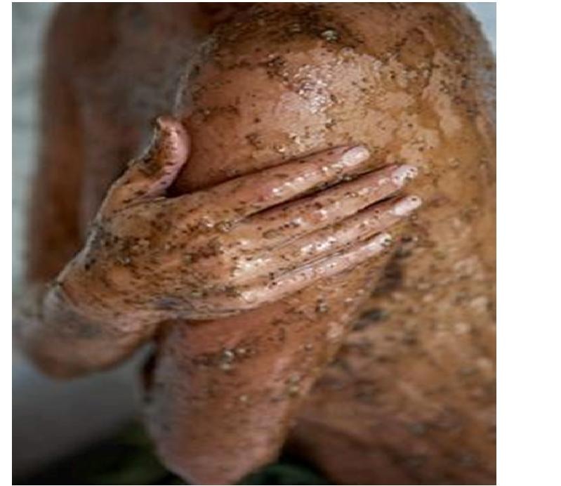 5 Weird Cures for Cellulite That Actually Work
