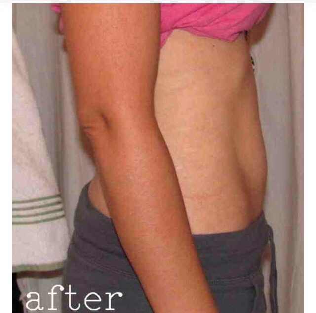 Different Ways To Lose Weight And A List Of Food Great For Weight Loss!!!!(: