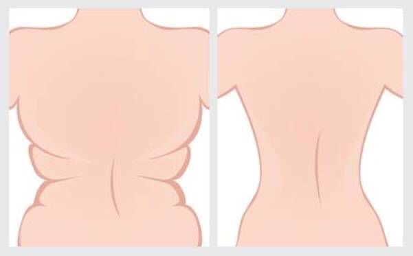Exercises To Get Rid Of Arm And Back Fat!!