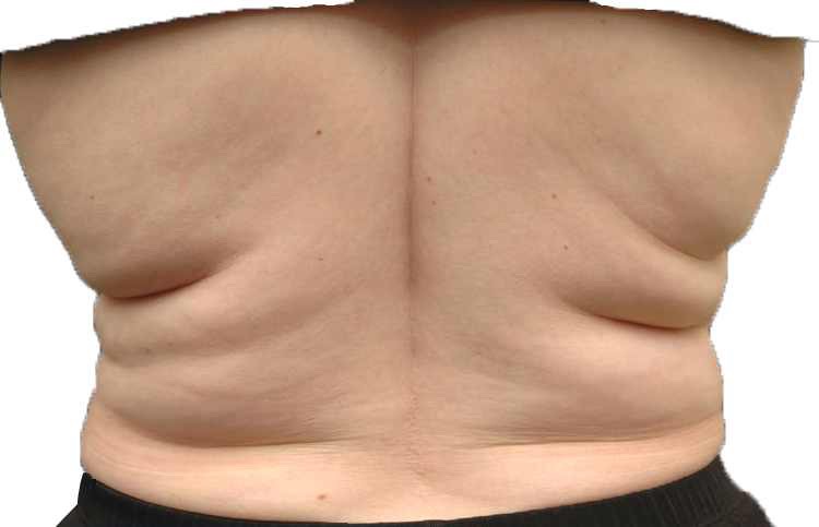 1) Cardio
If you are serious about losing back fat, then you got to get serious about cardio. Perform at least 30 mins of cardio a day 