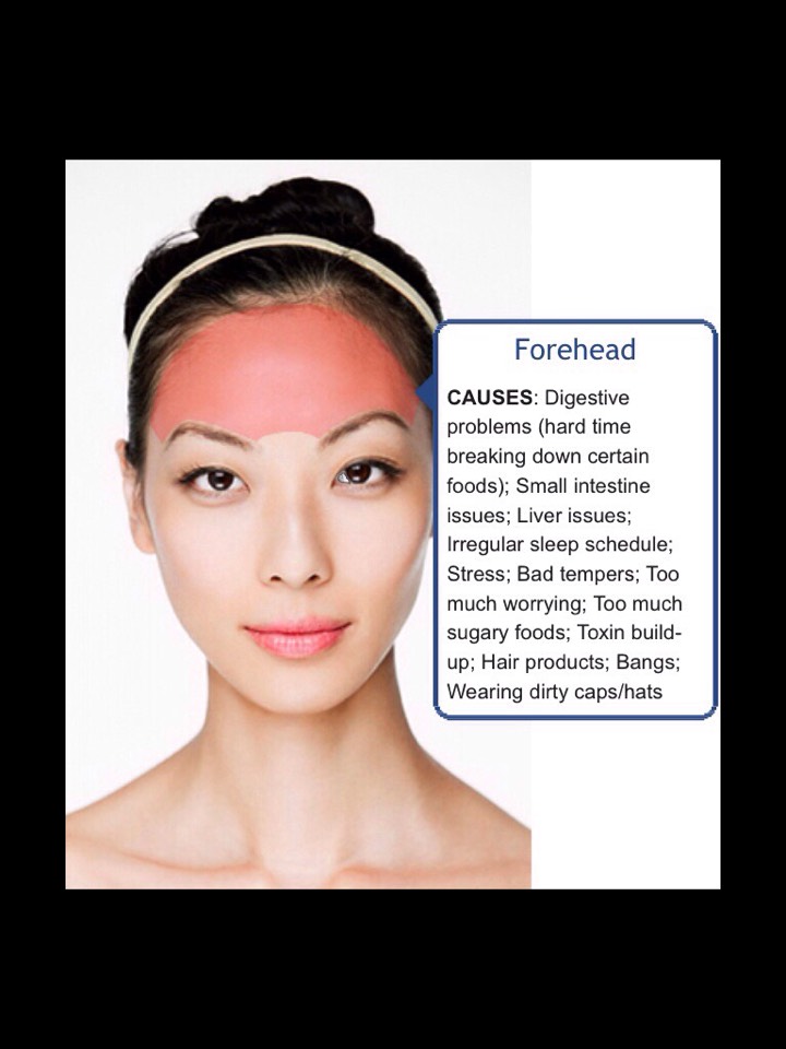 Face Mapping-What Your Acne Telling You? 😱👍👍