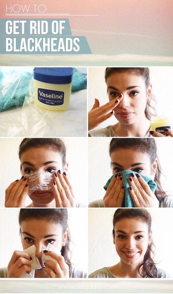 7. You can try using Vaseline and saran wrap to get rid of your blackheads.