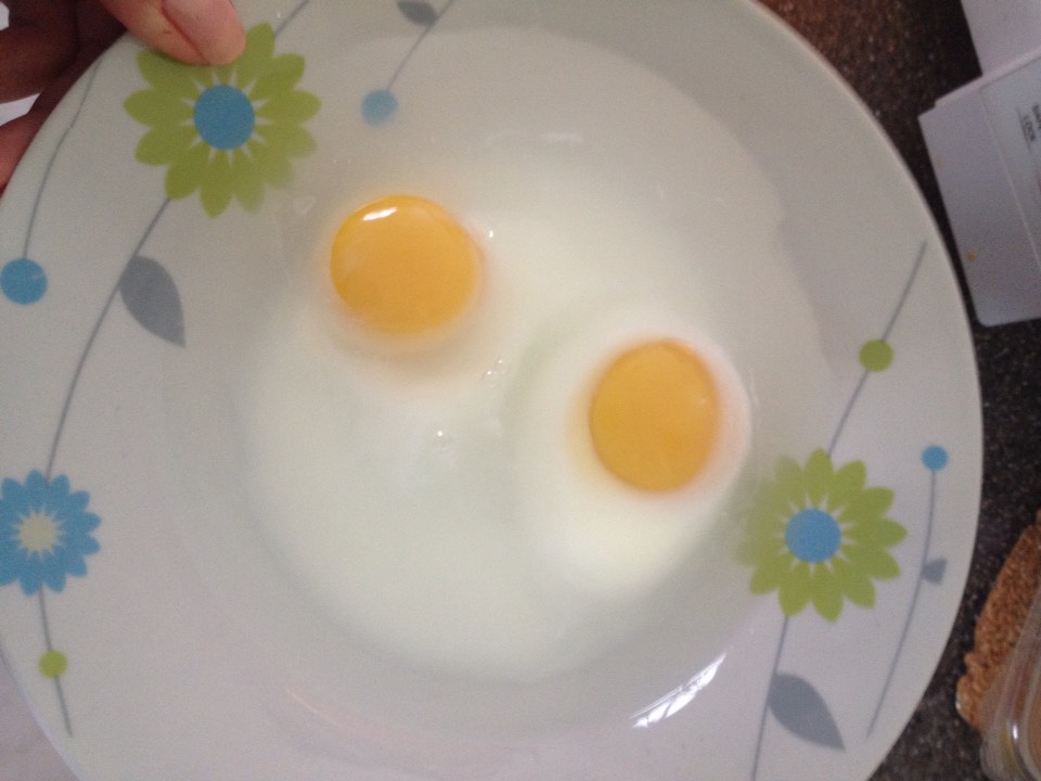 They should look like this: a little clear around the yolks means they are almost done. I usually turn the bowl a little and microwave them an additional 30 seconds. If you want them a little runny you can eat them now.
