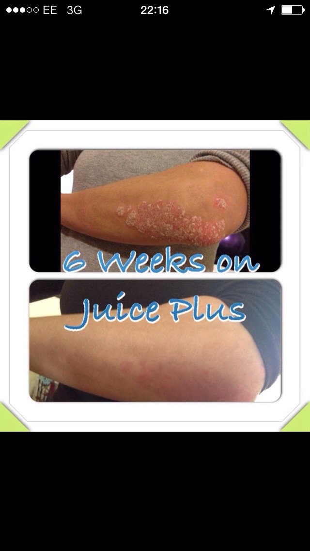 Juice Plus - Hair Growth Nail Growth And Clearer Skin  