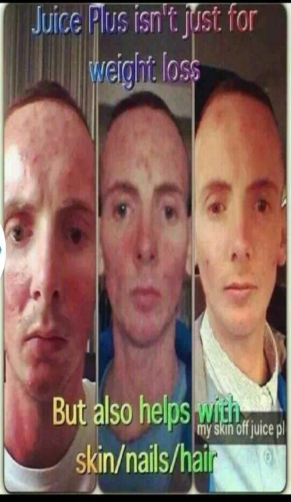 do you suffer from a skin condition? acne? Psoriasis?  dry skin?