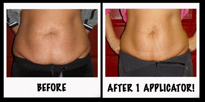 Wraps even help with post c-section saggy skin! Whaaaat?! 👂