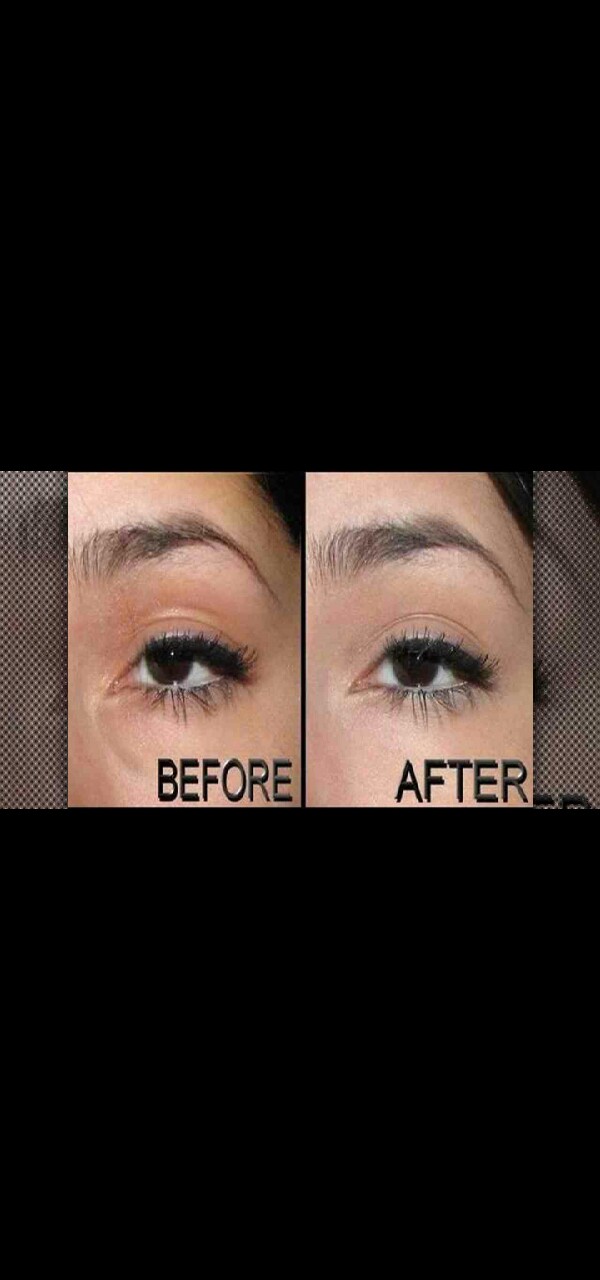 Before and After
