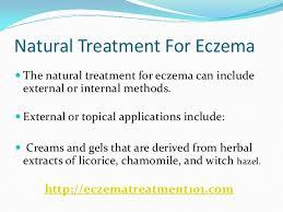 7 Natural Remedies For Eczema