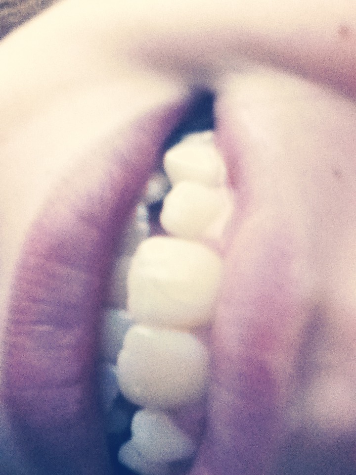 Lemon And Baking  Soda=white Teeth In A Week