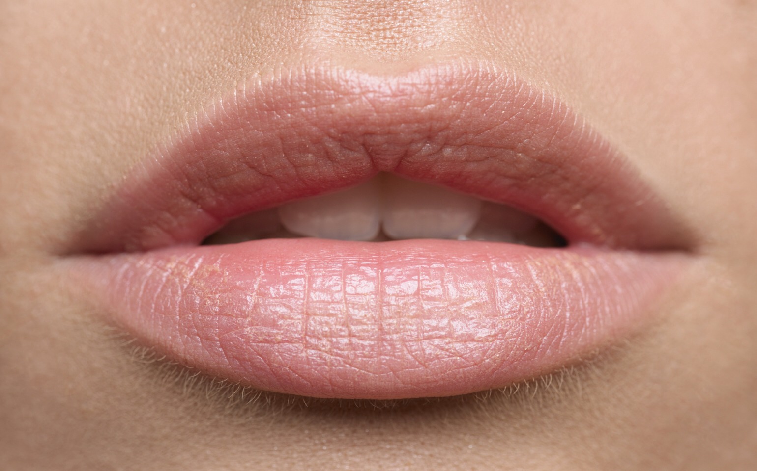 5. Put Vaseline on chapped lips

