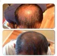 Hair Skin And Nail
