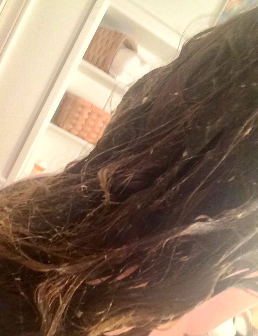 Give Life Back To Your Hair With Only Half An Avocado And One Egg! 