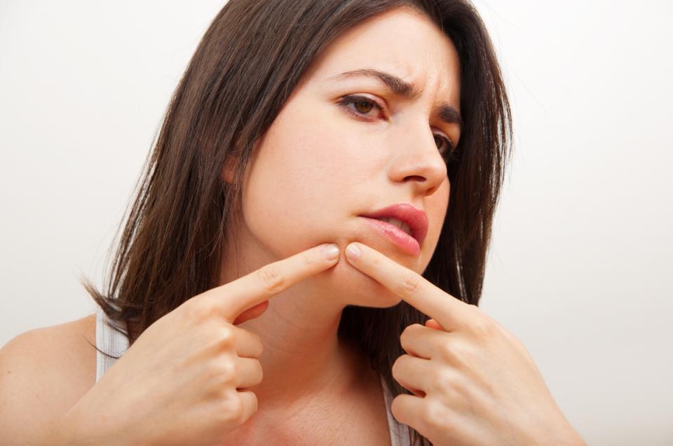 Don't Pop It
No, no, no! Don't pop your zits. Not only does it increase the chance of scarring, it's also likely that you will worsen the blemish and spread bacteria to other places on your face which could give rise to another breakout.