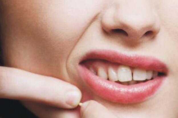 5. Should I pop my zits?
The short answer: no. You only make your blemish angry (red and irritated) when you pop it, since the pressure creates more inflammation. Not to mention, you could accidentally cut your skin and cause a scar that can block the pore and cause a resurgence of another zit in the same spot.