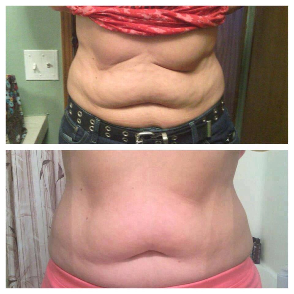 AMAZING! 
http://trishtightentone.myitworks.com