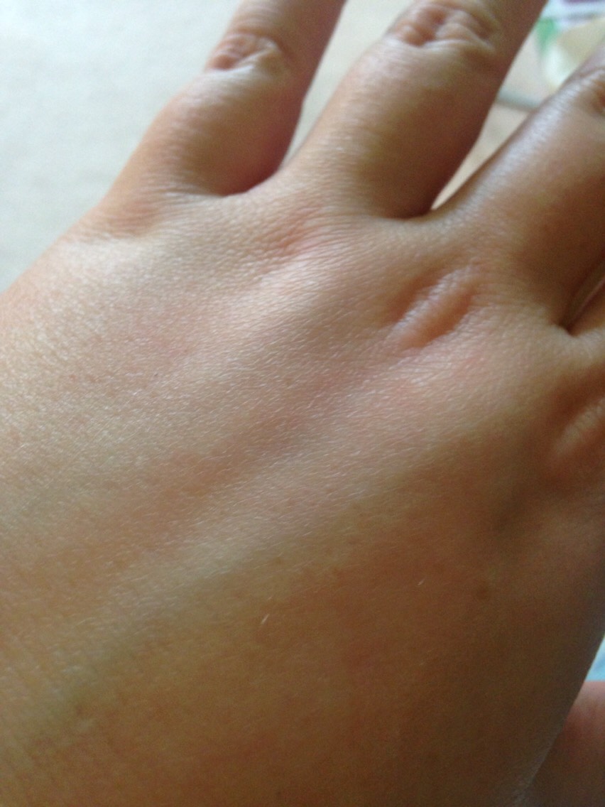 Rid Your Dry Skin!