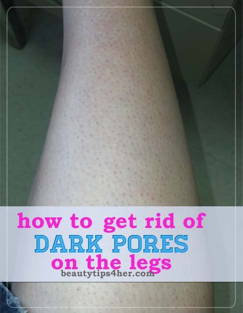 How To Get Rid Of Dark Pores On The Legs