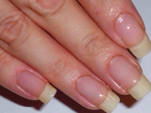 Apply to your nails constantly and they could be as long as theses.