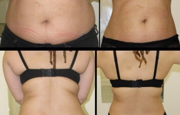 DIY body Wrap. REALLY WORKS!!