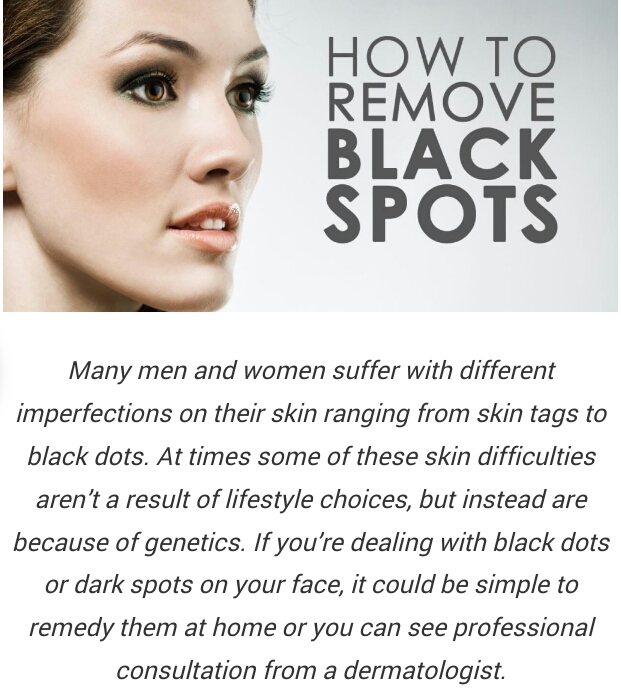 FAST GET RID OF DARK SPOTS 