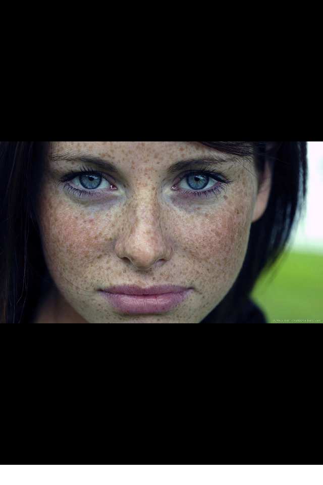 🙈• lighten freckles by applying sour cream or lemon juice to your freckles for 20 minutes every day