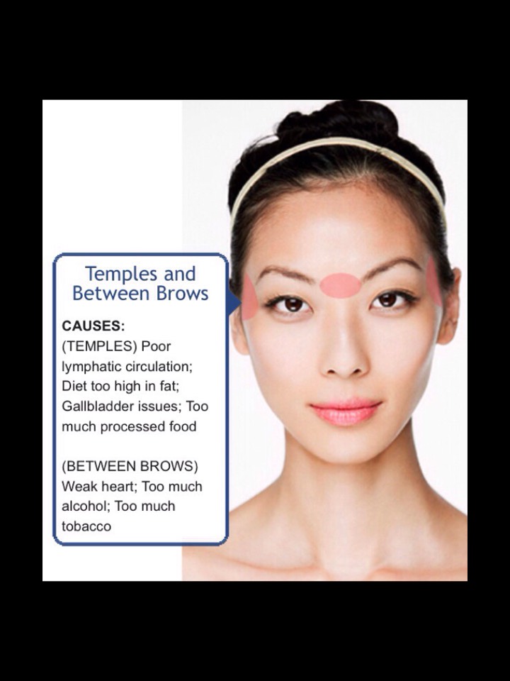 Face Mapping-What Your Acne Telling You? 😱👍👍