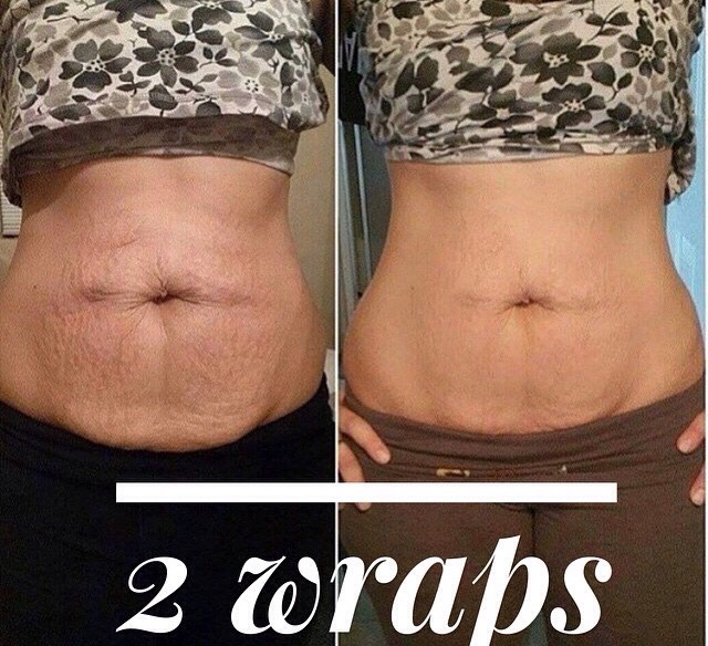 Lose Weight Fast And Cheap