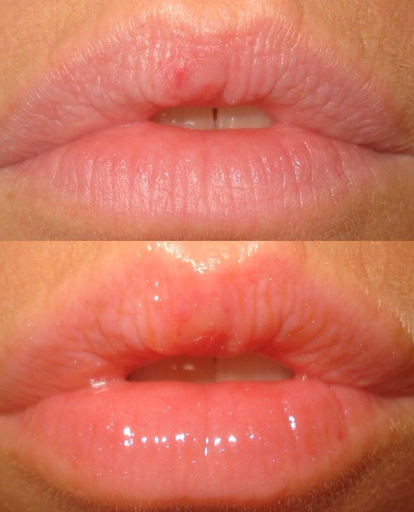Plump Pucker
After your lip balm, apply a few drops of peppermint OR cinnamon leaf oil to your lips. Proceed with your normal lip routine.
