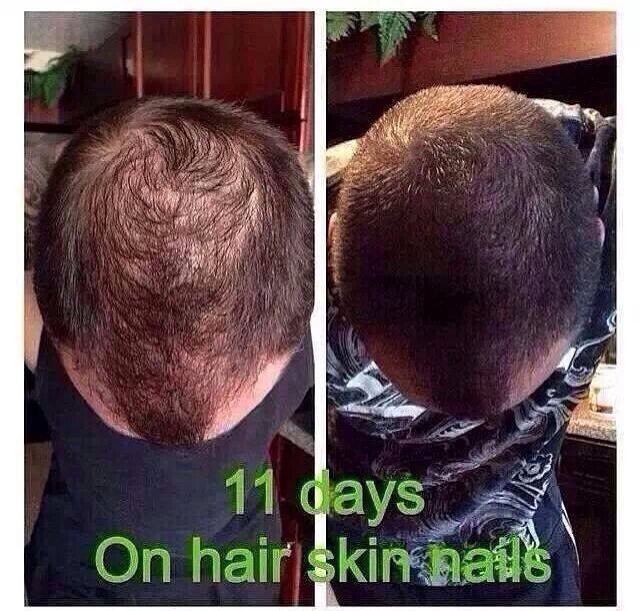 Even helps RE GROW thinning hair!!!!!!! 
http://trishtightentone.myitworks.com