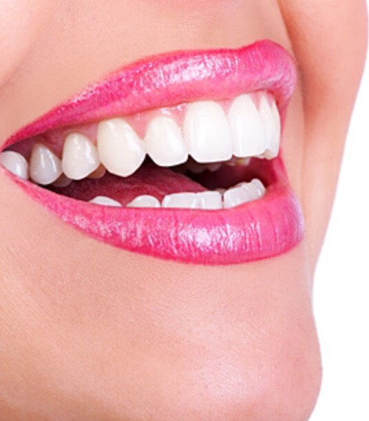 Putting a small amount of vaseline on your teeth before putting on lipstick will allow you to avoid having lipstick stains on your teeth.