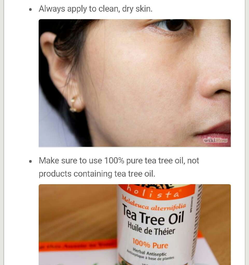 Tea Tree Oil for Acne