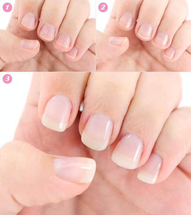 Grow 2-4 Inches Of Nail In 1 Week!!