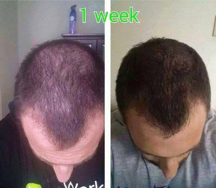 How To Grow Hair & Nails - Balance Skin