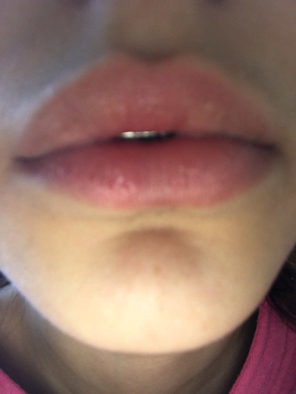 And these are after. Continued use is recommended