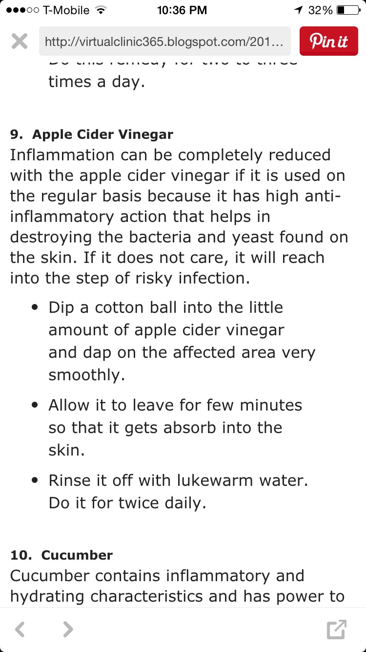 How To Get Rid Of Ingrown Hair! 