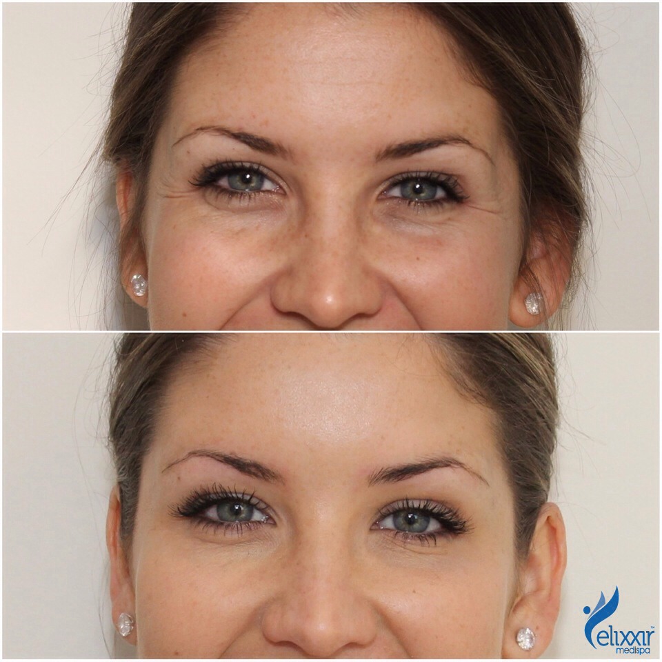 Reduces fine lines and wrinkles