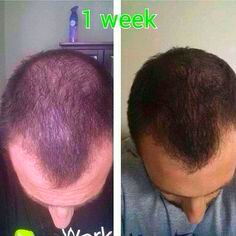 need help growing your hair? 