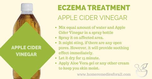 7 Natural Remedies For Eczema