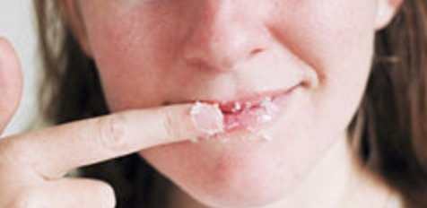 Once your mixture is complete take your finger and dip it inside your formula and rub it around and on your lips! The more you rub with pressure the better the results