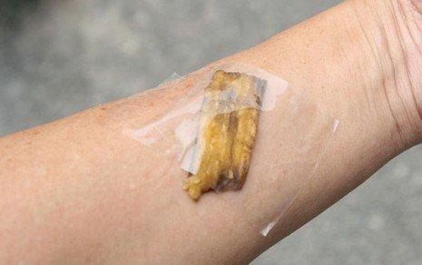 SPLINTER REMOVAL 

Tape some of the peel over your splinter. Enzymes assist to dislodge it and heal the wound.