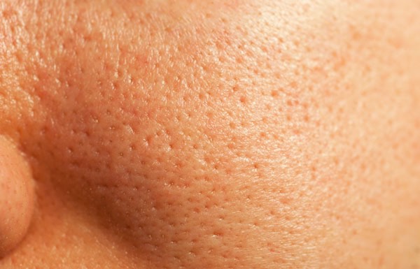 17 Effective Home Remedies For Skin Pores
