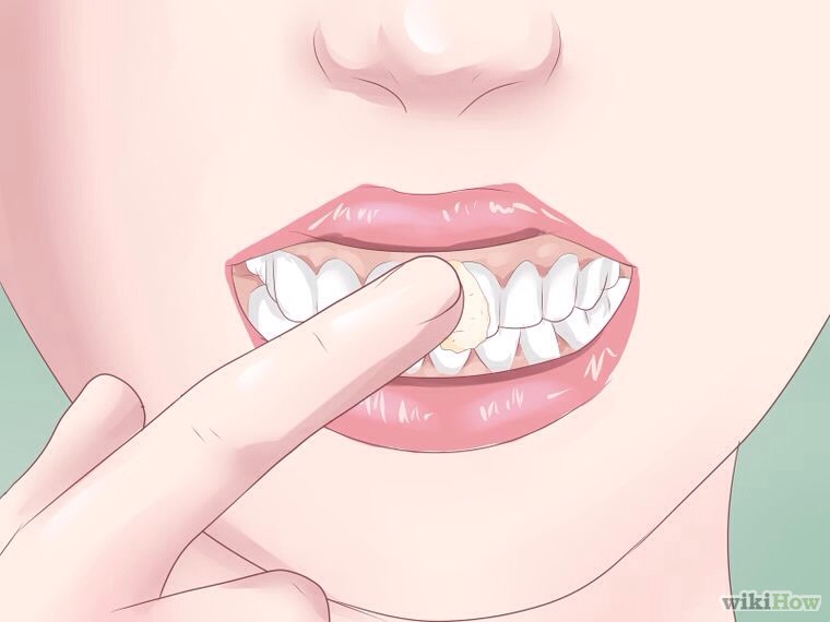 TEETH - While it may seem odd, applying Vaseline to the teeth is an old stage-hand trick, used to get dancers and other performers more enthusiastic about grinning. Vaseline prevents your lips from sticking to your teeth. Done correctly, it can prevent lipstick from getting on your teeth. 